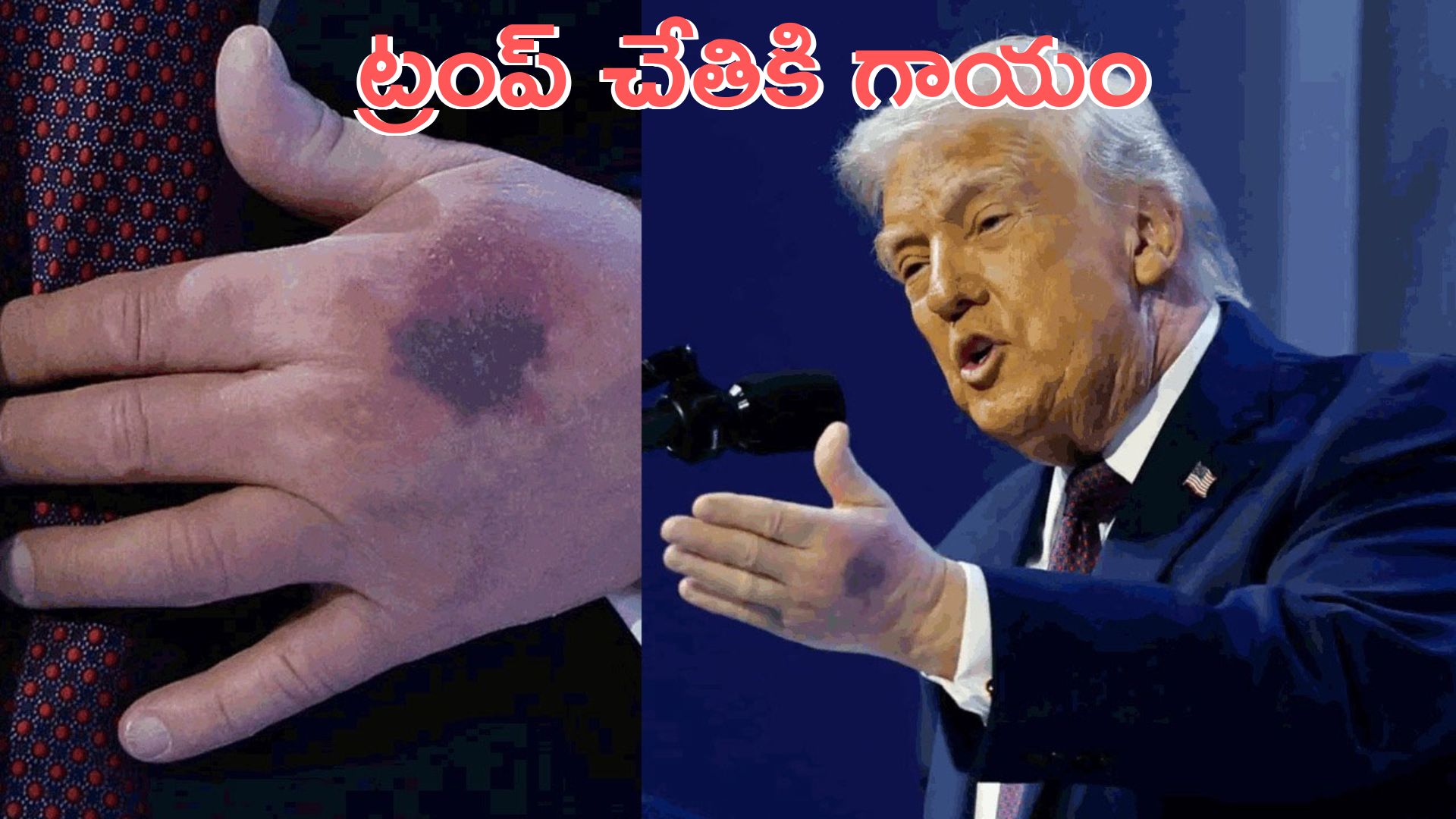 Donald Trump: అమెరికా అధ్యక్షుడు ట్రంప్‌‌కు గజ్జి, తామర..?