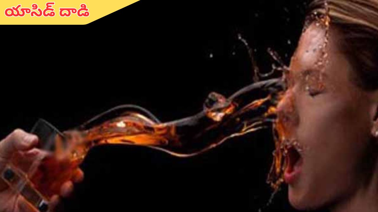 Delhi: ఢిల్లీలో దారుణం.. డిగ్రీ విద్యార్థినిపై యాసిడ్ దాడి