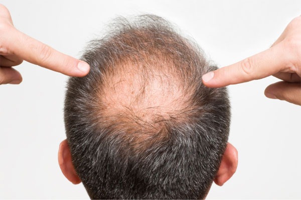 ఆరోగ్యం