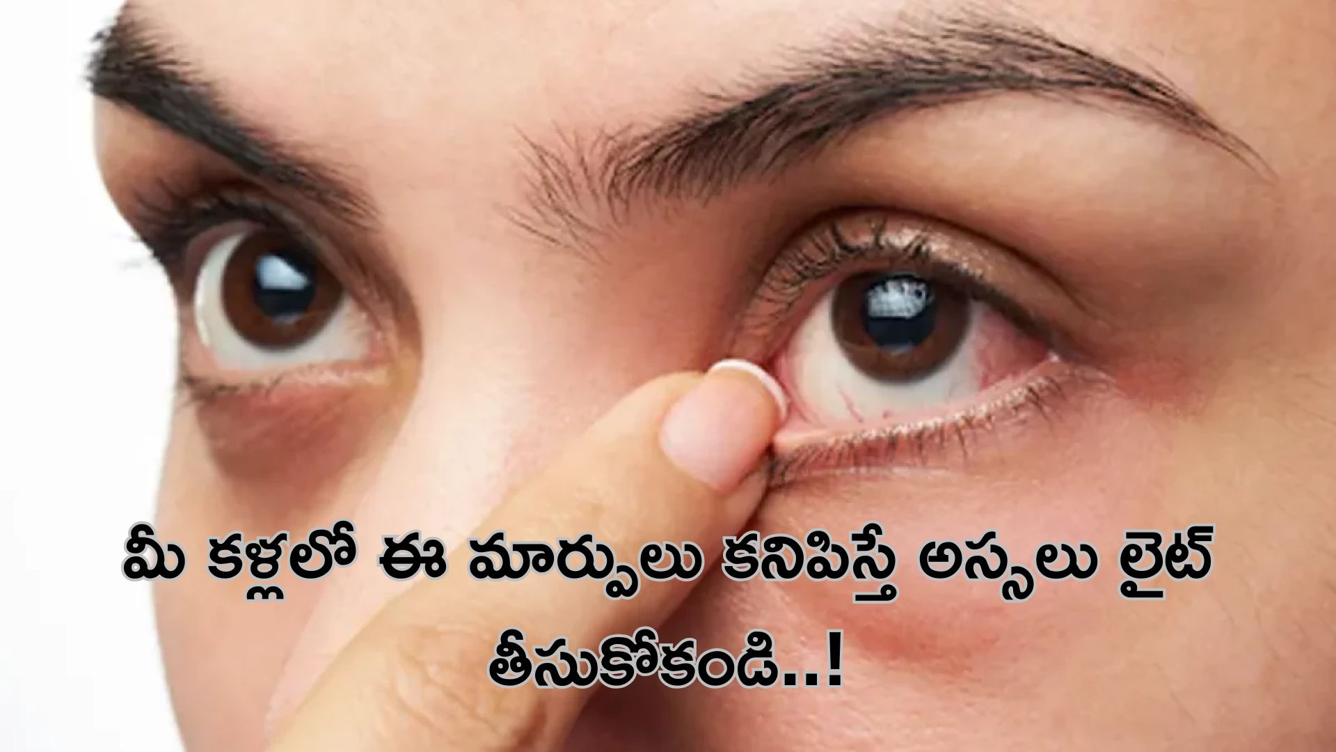 Symptoms In Eyes: మీ కళ్లలో ఈ మార్పులు కనిపిస్తున్నాయా? అయితే అస్సలు లైట్ తీసుకోకండి..!