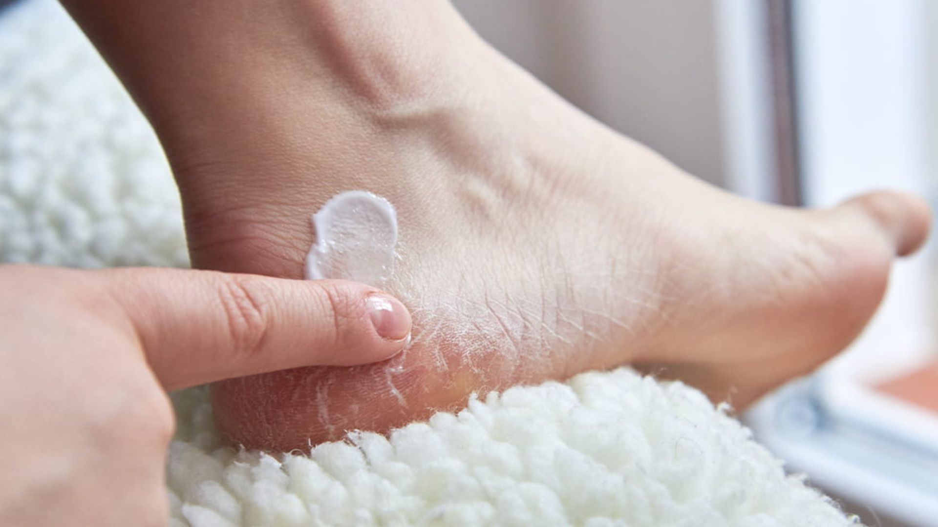 Home Remedies: శీతాకాలంలో మడమలు పగులుతున్నాయా..? అయితే ఈ జాగ్రత్తలు తీసుకోండి..!