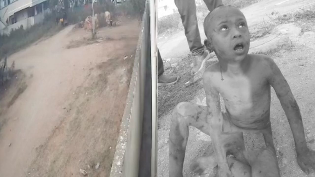 CM Revanth Reddy: హైదరాబాద్‌లో మూగబాలుడిపై కుక్కల దాడి.. స్పందించిన సీఎం రేవంత్ రెడ్డి