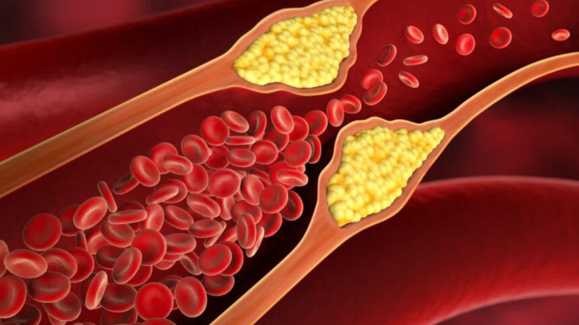 Cholesterol: శీతాకాలంలో కొలెస్ట్రాల్ పెరగకుండా తీసుకోవాల్సిన ఆహారాలు ఇవే..!