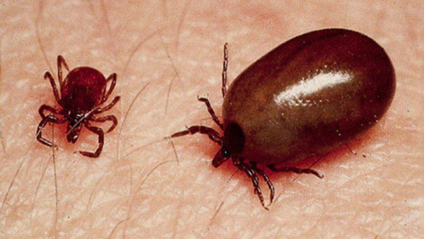 Danger Bells in AP: విజృంభిస్తున్న స్క్రబ్ టైఫస్.. ఐదుకు చేరిన మృతుల సంఖ్య