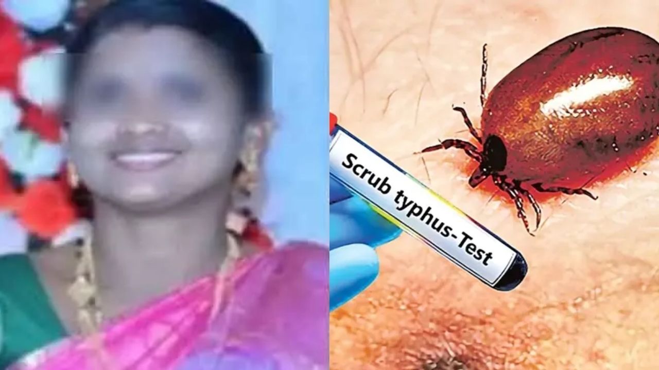scrub typhus: ఏపీలో ‘స్క్రబ్ టైఫస్’కలకలం.. ఒకరు మృతి